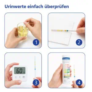 LuxmedIQ Urin Teststreifen 11 Parameter Anwendung